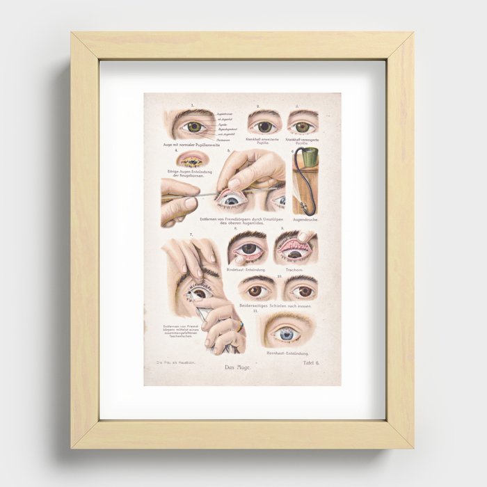 Eye health Recessed Framed Print