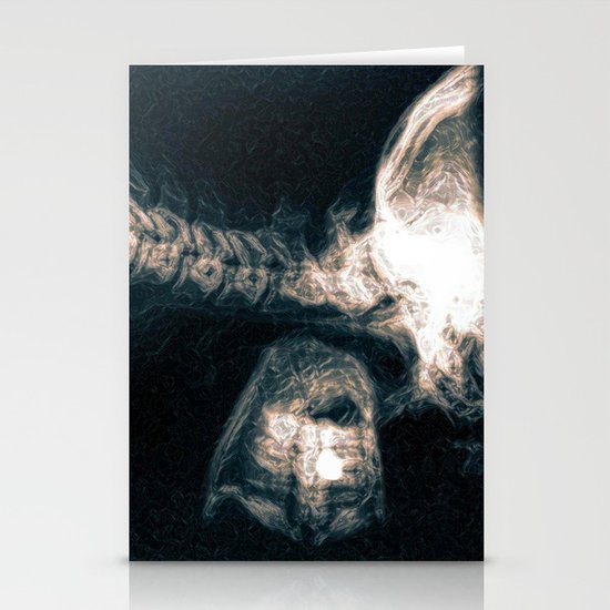 Pain in the Neck Stationery Cards