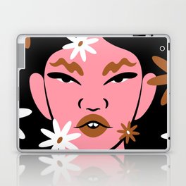 Blooming Laptop Skin