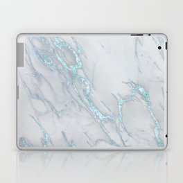 Marble Love Sea Blue Metallic Laptop Skin