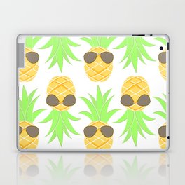 Life of the Fineapple Laptop & iPad Skin