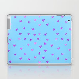 Little Shiny Hearts - Love Laptop Skin