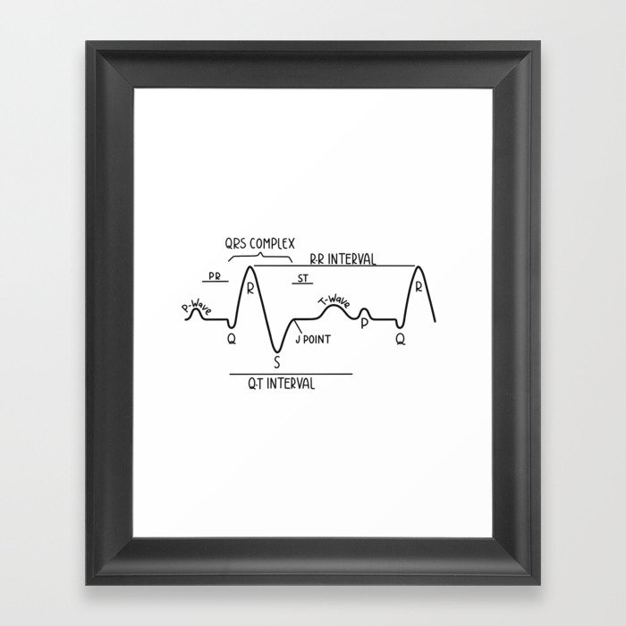 Hand Drawn Normal Electrocardiogram Black Framed Art Print