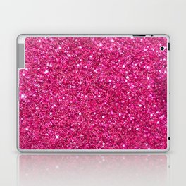 pink glitter Laptop Skin