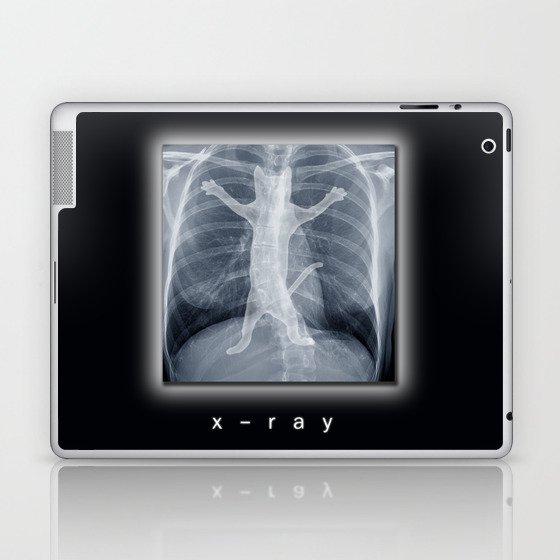 x-ray Laptop & iPad Skin