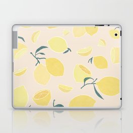 zesty yellow Lemon Laptop Skin