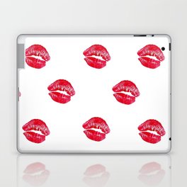 Kiss Kiss Laptop & iPad Skin