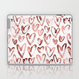 Rose Gold Love Hearts on Marble Laptop Skin