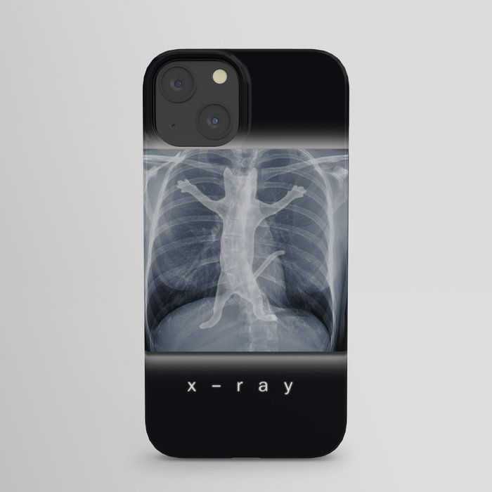 x-ray iPhone Case