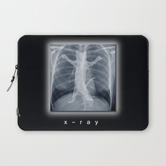 x-ray Laptop Sleeve