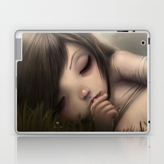 Anesthesia Laptop & iPad Skin