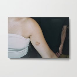 some girl's bestfriend's party bruise on arm Metal Print