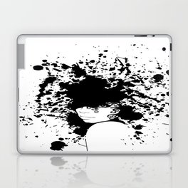 Raye 6 Splatter Laptop & iPad Skin