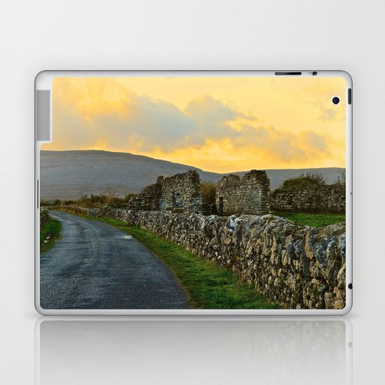 The Road Back to Dublin Laptop & iPad Skin