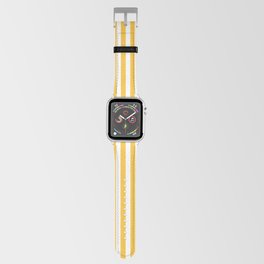 Singing Canary  Apple Watch Band