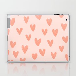 Red Hearts Laptop Skin