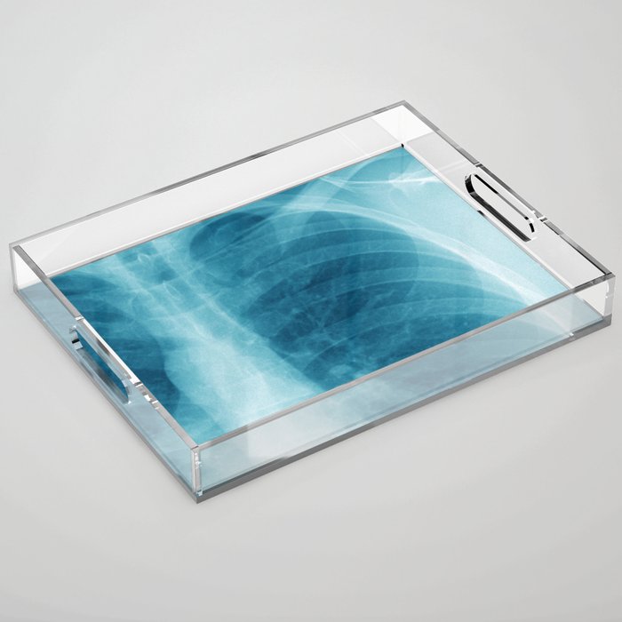 X-Ray Acrylic Tray