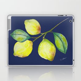 The Lemon branch - Navy Laptop & iPad Skin