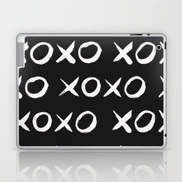 XOXO Hugs Kisses Pattern Laptop Skin