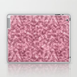Luxury Pink Sparkle Pattern Laptop Skin