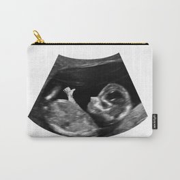Thumbs up - Ultrasound baby Carry-All Pouch
