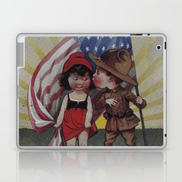 An Adorable Kiss Under American Flag - Simpathy Peace Usa & Russia Laptop Skin
