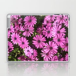 Magenta Pink Osteospermum Flowers In The Garden Photograph Laptop Skin