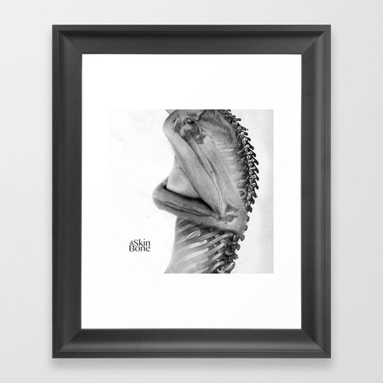 Skin & Bone Framed Art Print