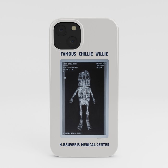 X-Ray of Famous Chillie Willie iPhone Case