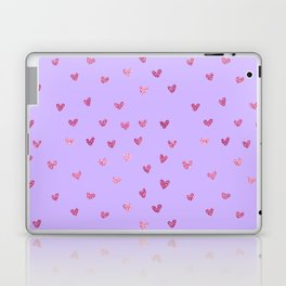 Pink And Purple Hearts Laptop Skin