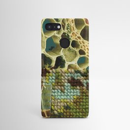 Tapestry Android Case