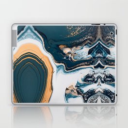 Gold and Blue Laptop Skin