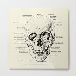 Vintage Anatomy Skull  Metal Print