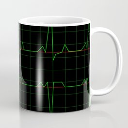 Normal Heart Rhythm Coffee Mug