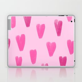 Pink Be My Valentine Hearts  Laptop Skin