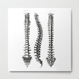 Bone column Metal Print | Skeleton, Bone, Columna, Painting, Huesos, Esqueleto, Bones, Hueso, Column, Spine 