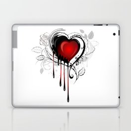 Bleeding Heart Laptop Skin