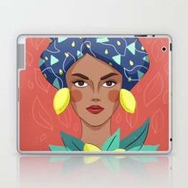 Sicilian Woman - Testa Di Moro Lemon Laptop & iPad Skin