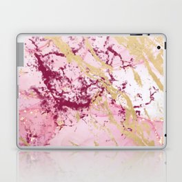 Pink and Purple Gold Metallic Pattern  Laptop Skin