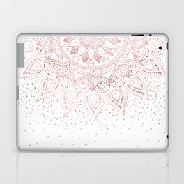 Elegant rose gold mandala confetti design Laptop & iPad Skin
