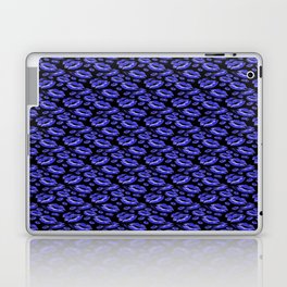 Two Kisses Collided Lip Affectionate Bold Blue Lips Pattern Laptop Skin
