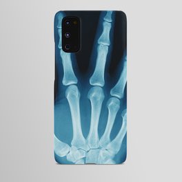 Hand X-Ray Android Case