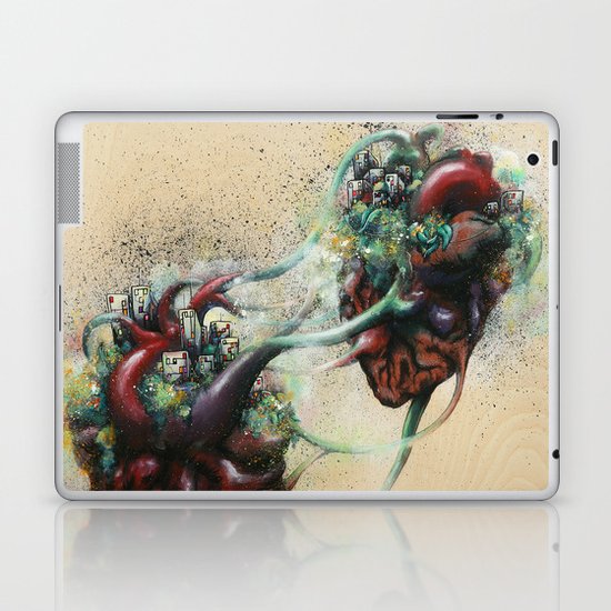 Arrested Vascular Fusion of Two Entities in Need Laptop & iPad Skin