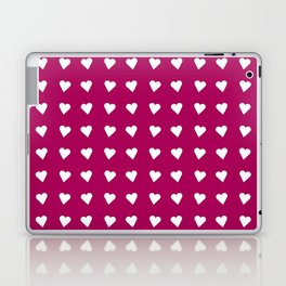 Heart and love 38 Laptop Skin