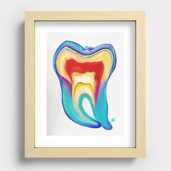 polarised tooth 1 Recessed Framed Print