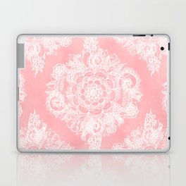 Marshmallow Lace Laptop Skin