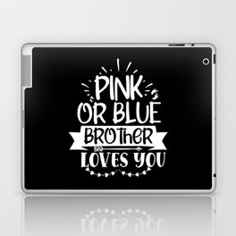 Pink Or Blue Brother Loves You Laptop Skin
