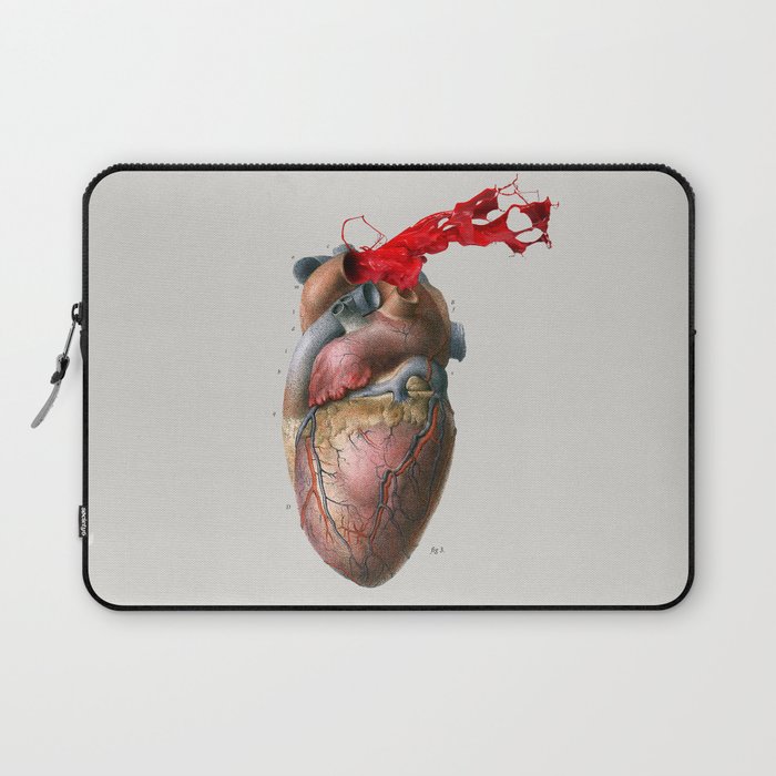 Broken Heart - Fig. 3 Laptop Sleeve