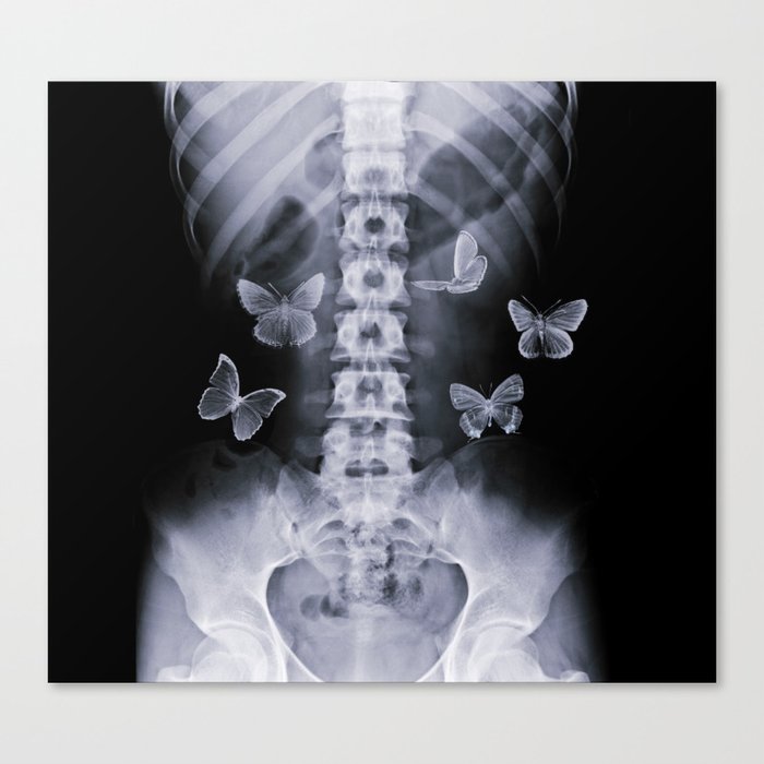 X-Ray Conceptual Butterflies  Canvas Print
