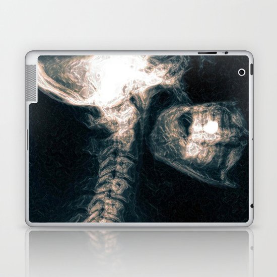 Pain in the Neck Laptop & iPad Skin